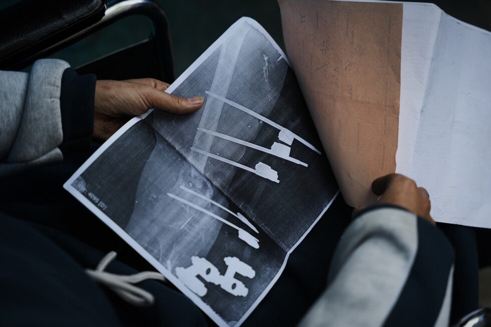 A Gaza teen waits for Rafah border crossing to open so she can get surgery abroad